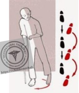 راه رفتنCircumduction